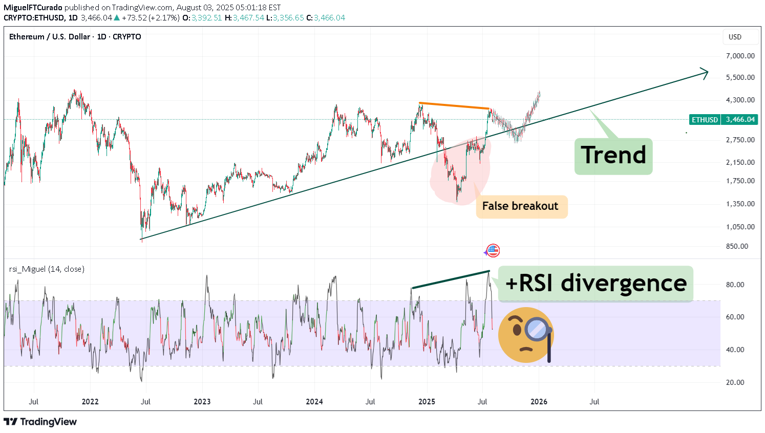 خریدETH،تکنیکال،MiguelFTCurado