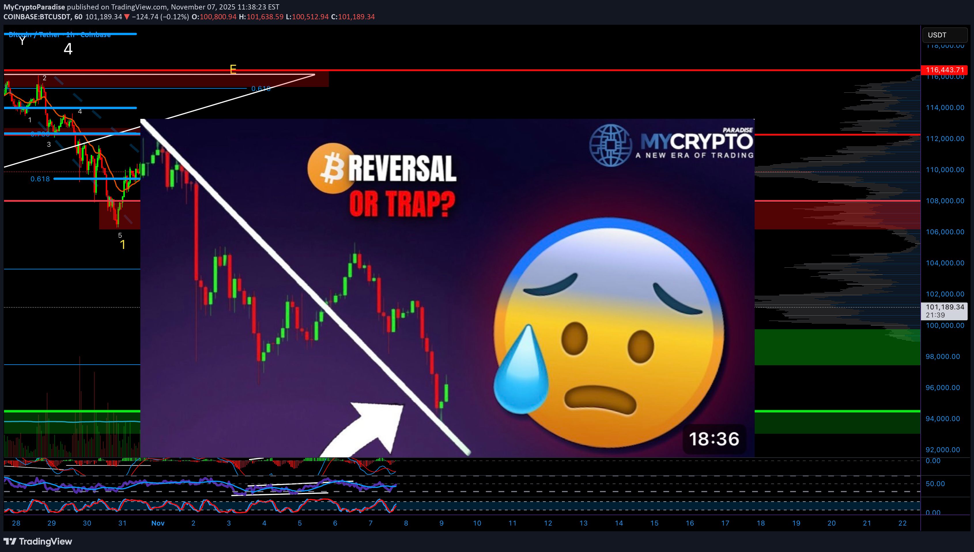 فروشBTC،تکنیکال،MyCryptoParadise