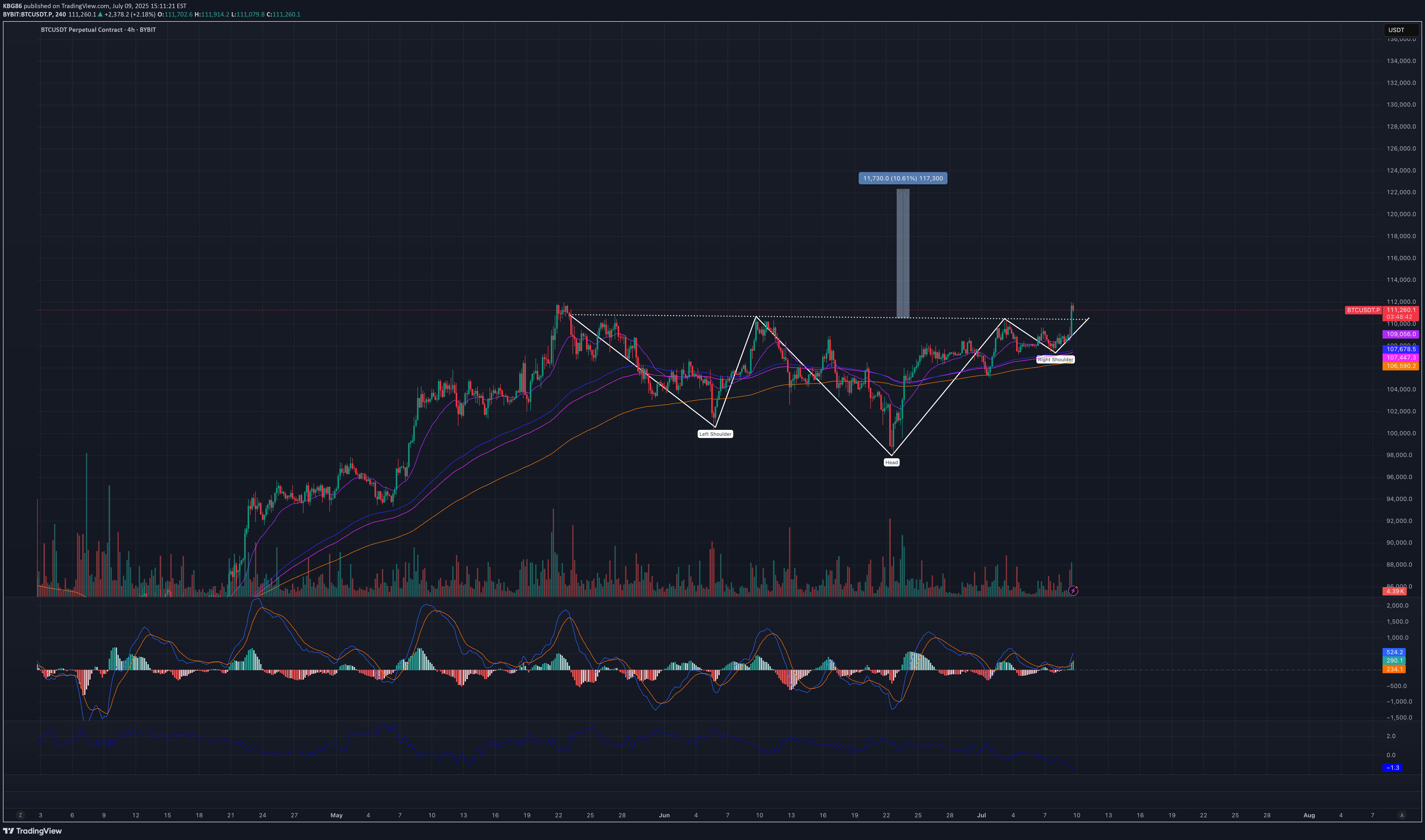 Satın alBTC،Teknik،KBG86