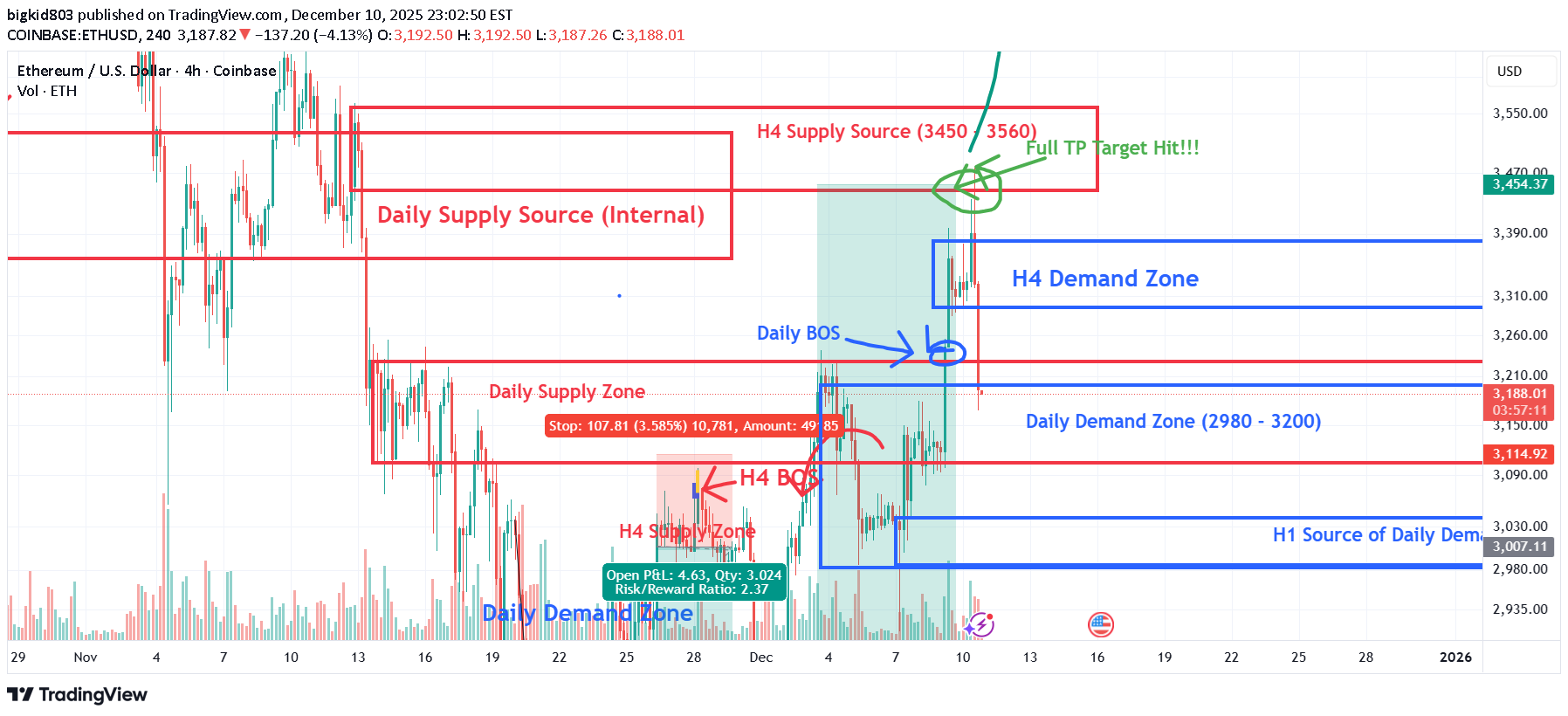 ETH،Teknik،bigkid803