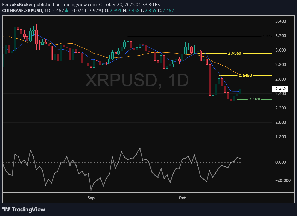 XRP،تکنیکال،FenzoFxBroker