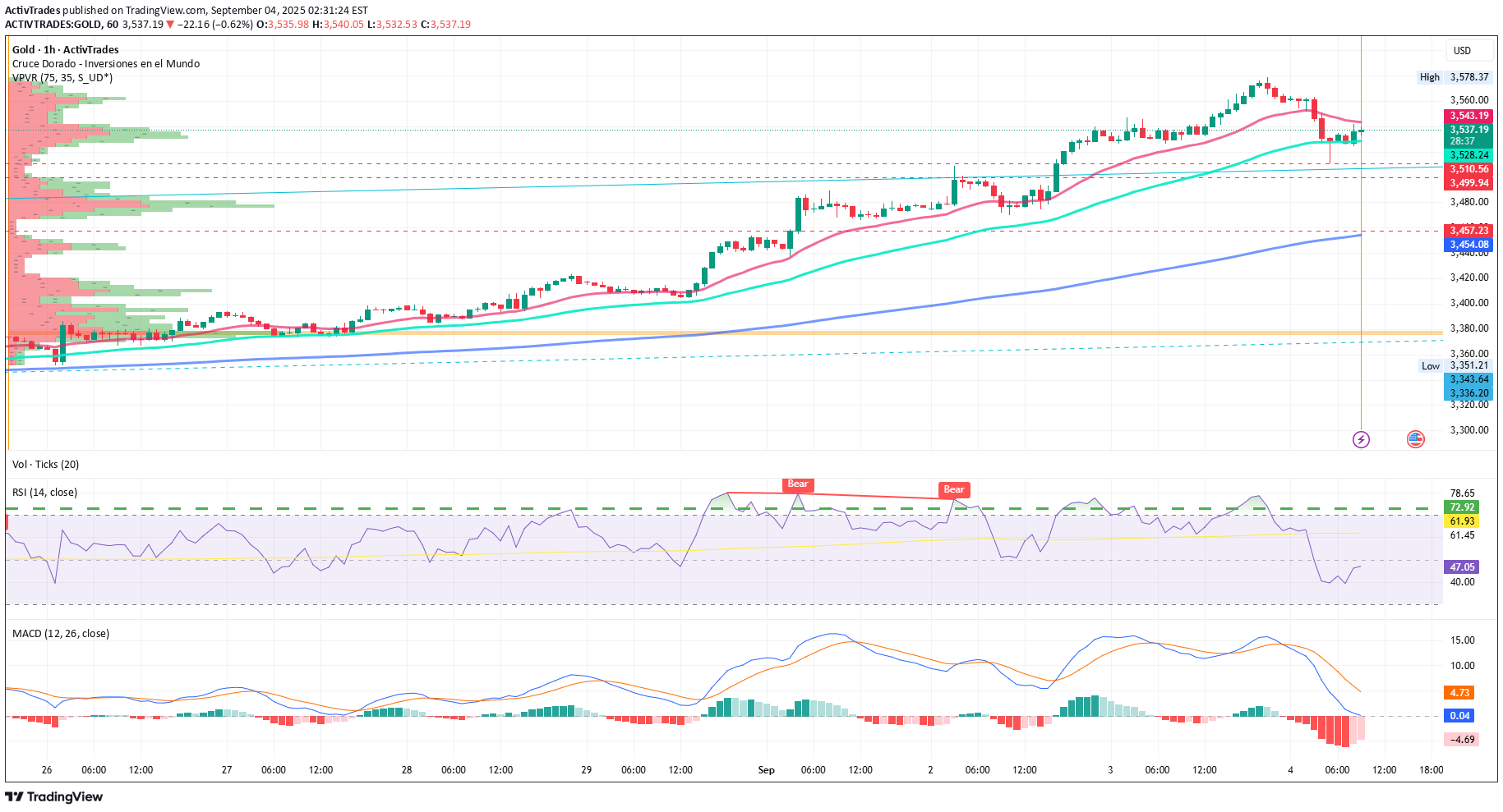 BuyPAXG،Technical،ActivTrades