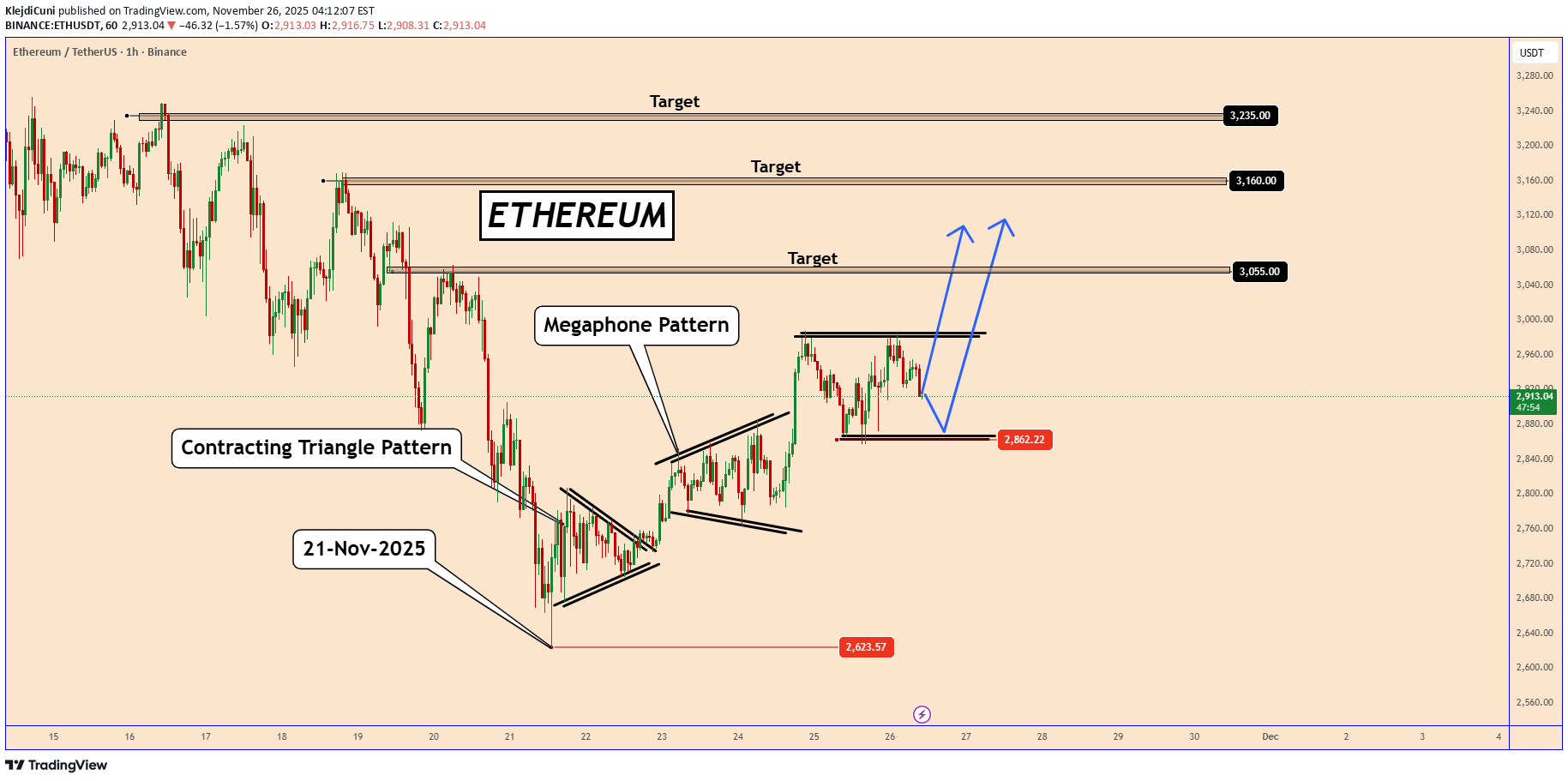 خریدETH،تکنیکال،KlejdiCuni