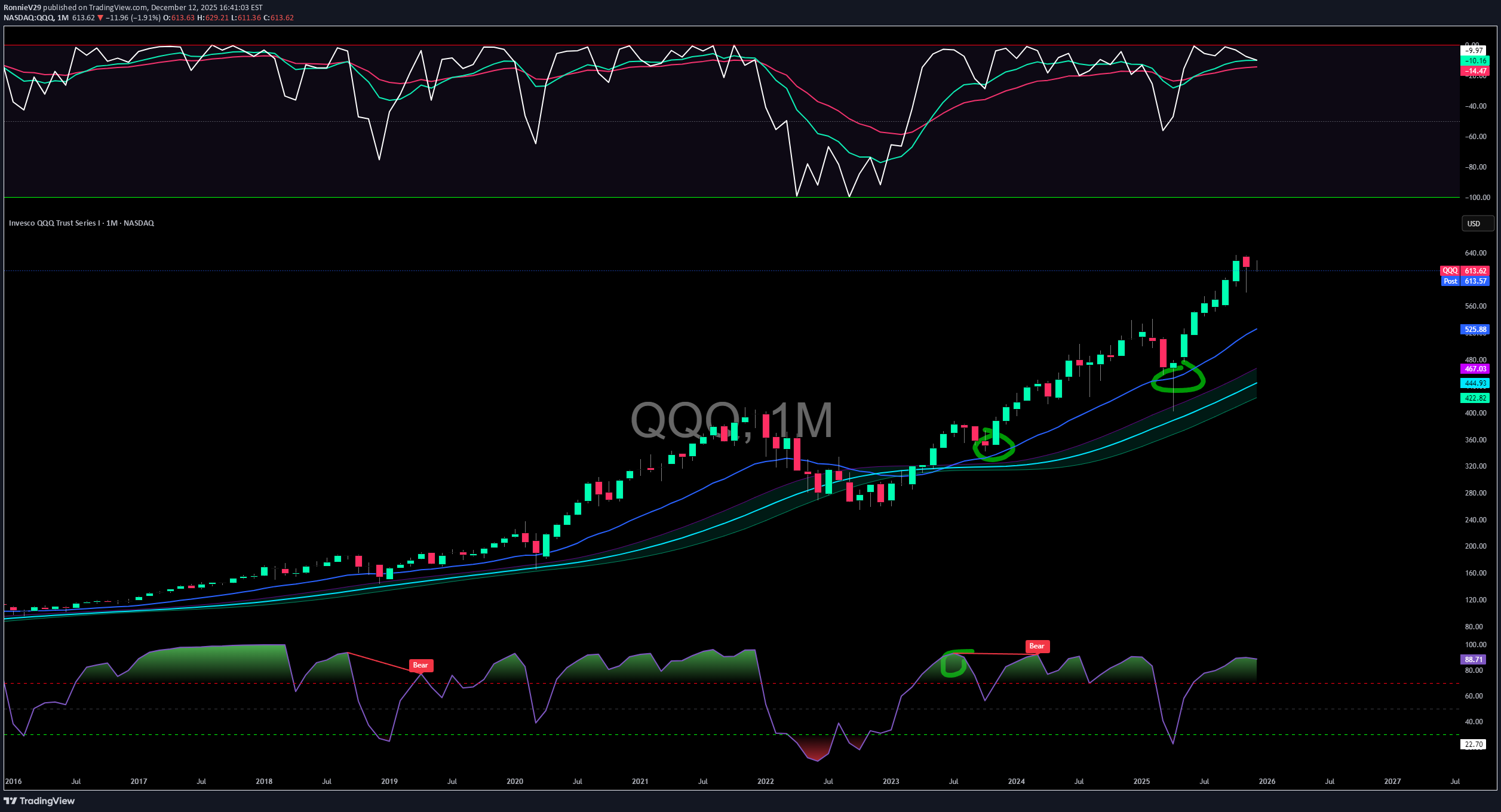QQQX،Teknik،RonnieV29