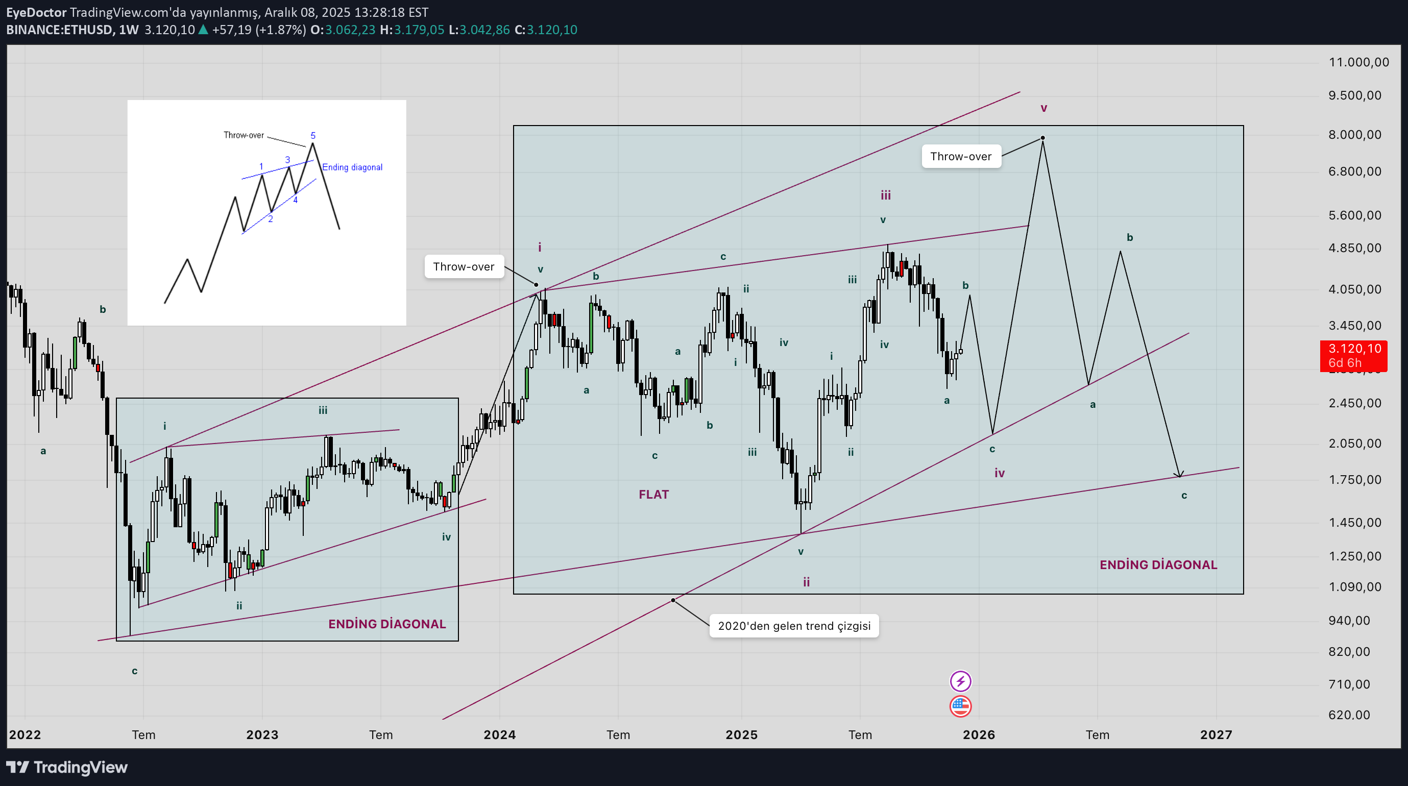 ETH،التحليل الفني،EyeDoctor